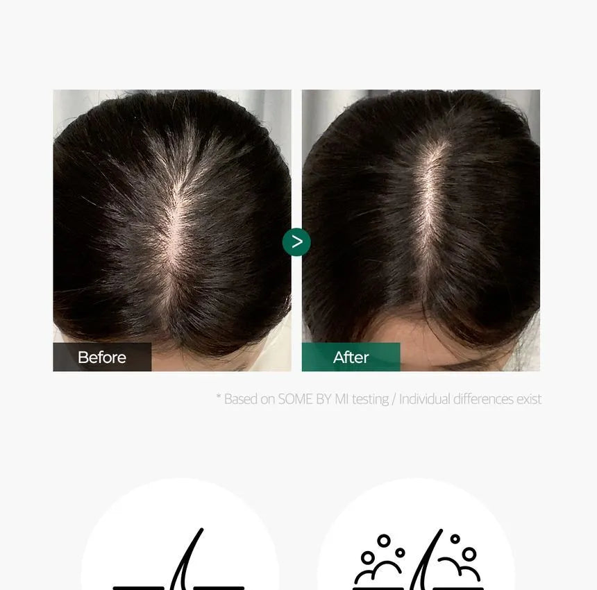 Some By Mi Miracle Hair & Body Starter Kit