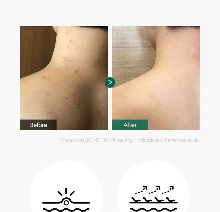 Some By Mi Miracle Hair & Body Starter Kit