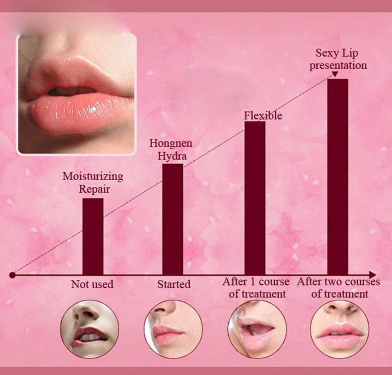 Collagen Lip Mask 1pc