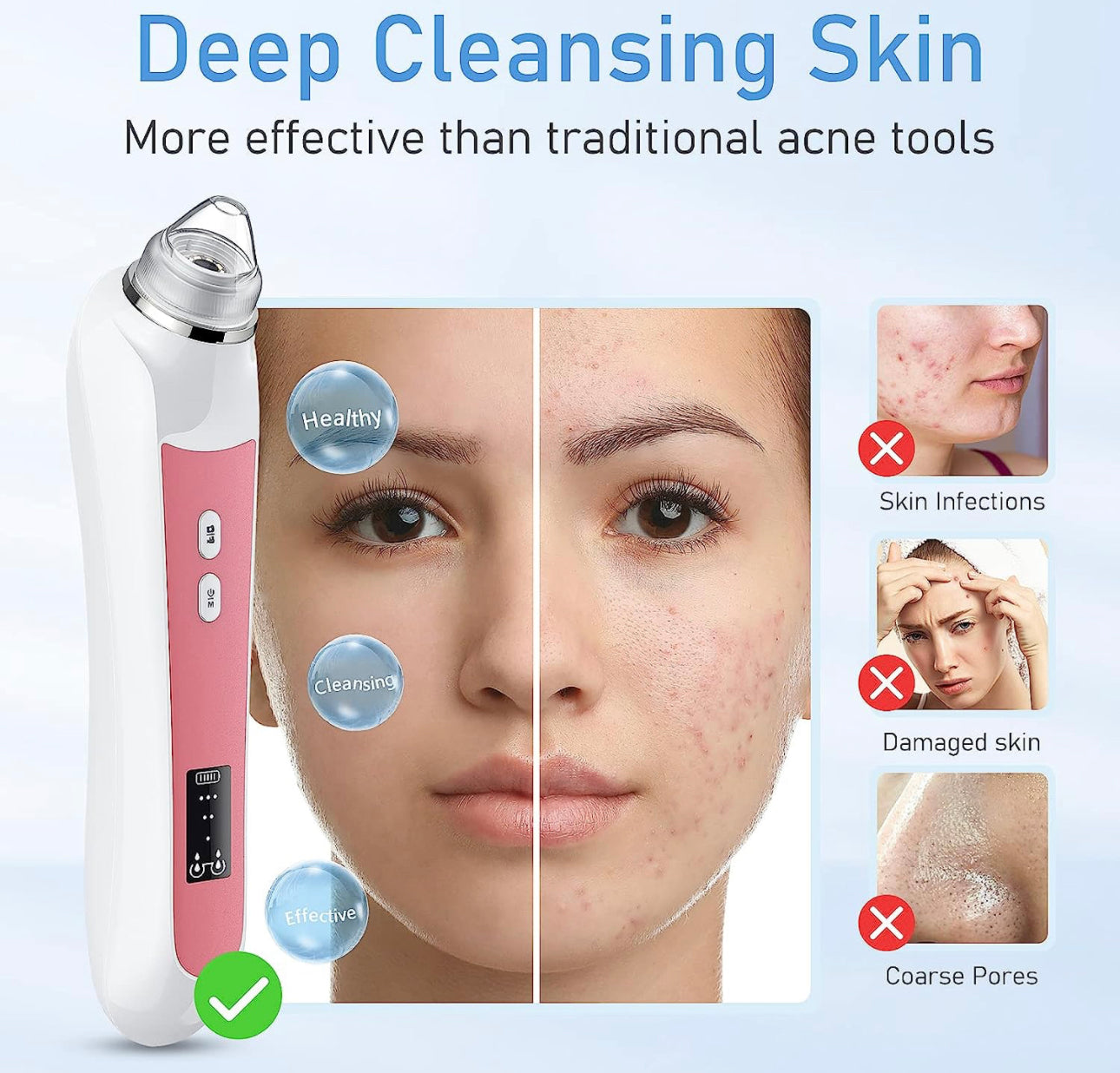Vacuum Blackhead Remover with Camera