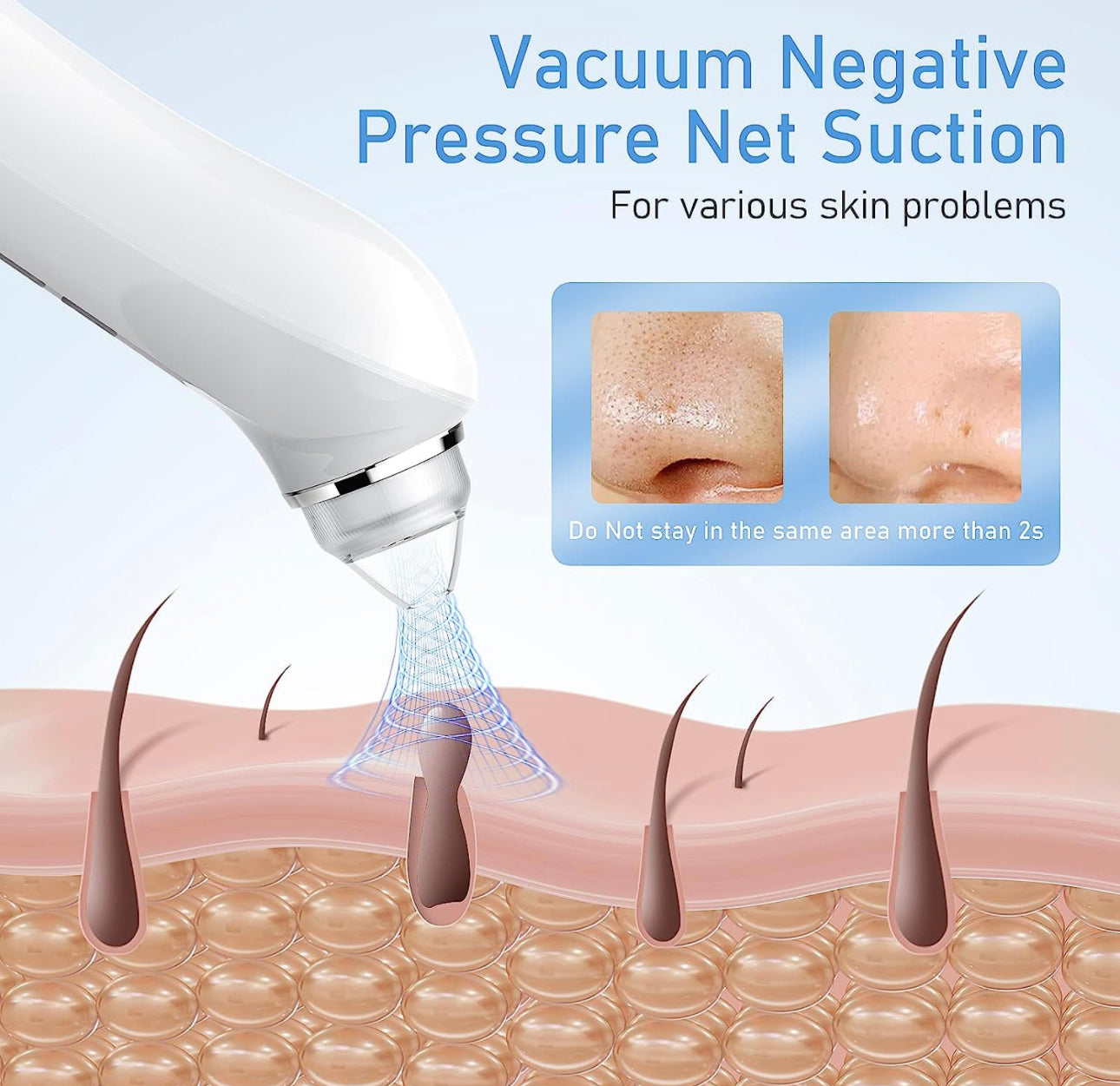 Vacuum Blackhead Remover with Camera