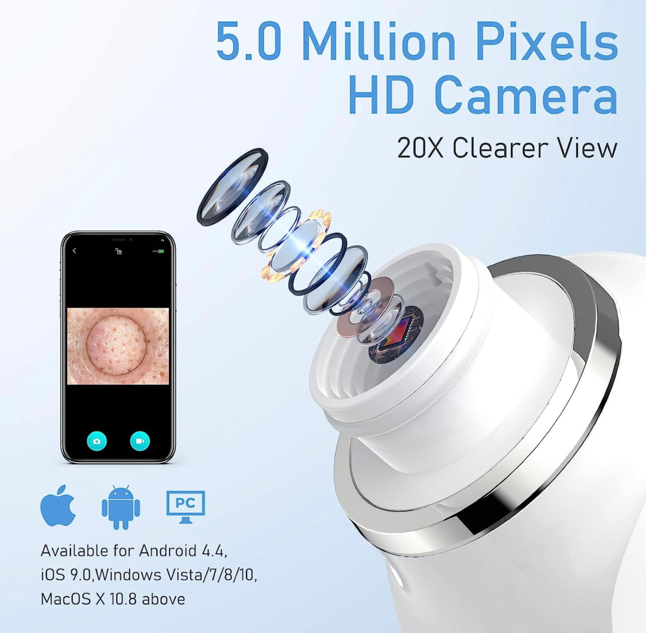 Vacuum Blackhead Remover with Camera