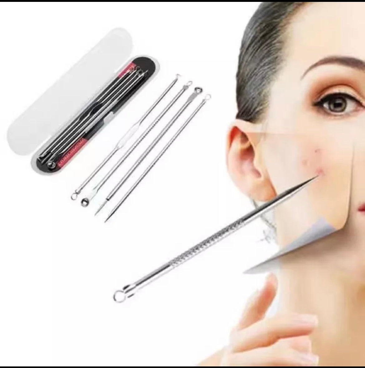 Acne Blackheads Pimple Remover 4Pcs Set in Case Facial Tool